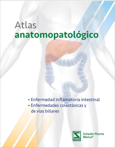 Imagen 1 reel seccion Atlas