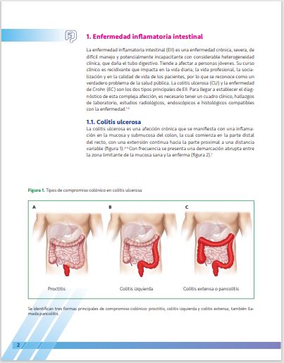 imagen 4 reel atlas